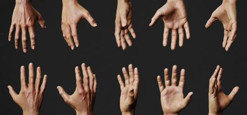 Нам не страшен артроз кистей рук. Причины остеоартроза кистей рук