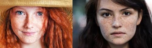 Как убрать возрастные пигментные пятна. Что такое пигментные пятна? 04