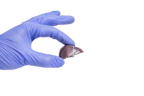 Как COVID-19 влияет на жировой гепатоз